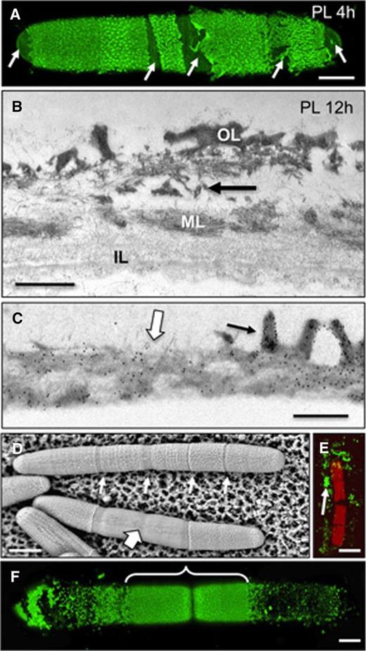 Effects of PL on lattice formation. A, Confocal image of a cell incubated with PL for 4 h and then labeled with JIM5. Arrows indicate areas of wall digestion. B, TEM image of the cell wall showing the degradation of the OL at its intersection with the ML (arrow). C, JIM5 immunogold labeling of the interface zone of a PL-digested wall and an undigested wall of a cell treated for 12 h. The OL (black arrow) of the undigested zone and the ML of both digested and undigested zones (white arrow) are labeled. D, VPSEM image of PL-treated cells. Initial digestion of the lattice occurs at lattice-free zones of the cell such as the isthmus and lateral bands (small arrows). Further digestion removes large segments of the outer lattice (large arrow). E, JIM5-labeled cell after 36 h of PL digestion. Only remnants of the lattice remain (arrow). F, JIM5 labeling after the cell is allowed to recover for 8 h after 24 h of PL treatment. The area of new lattice formation at the isthmus is bracketed. Bars = 5 µm (A and F), 500 nm (B), 550 nm (C), 16 µm (D), and 25 µm (E).
