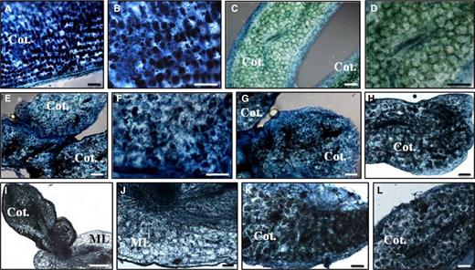 Detection of oil bodies stained with Sudan IV Black B in wild-type and transgenic functional KdLEC1 somatic embryos. A to B, Section of zygotic pumpkin cotyledon (positive control). B, Detail of cells in A showing oil body deposition (black spots). C to D, Section of a K. daigremontiana wild-type somatic embryo. D, Close view of C showing the absence of oil bodies in wild-type cotyledon cells. E to L, Sections of Kd2 (E and F), Kd4 (G), Kd5 (H), Kd6 (I and J), Kd7 (K), and Kd9 (L) transgenic somatic embryos. F, Close view of a cotyledon region in E. Note oil body deposition in these cells was similar to B. I, Section of Kd6 transgenic somatic embryo still attached to the mother leaf (ML). J, Close view of the ML in I showing the absence of oil bodies in the ML tissues. Bars = 10 μm.