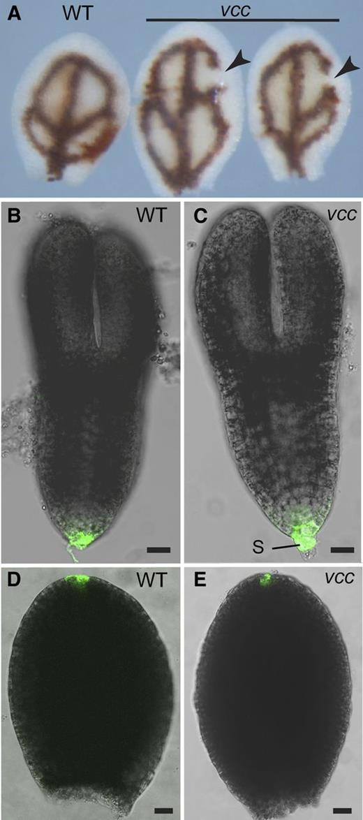 Analysis of vcc embryos. A, Mature wild-type (WT) and vcc-2 cotyledons were stained with Perls/DAB (Roschzttardtz et al., 2009) to detect iron accumulation in the proendodermis that surrounds procambial strands. Vein disconnections or gaps (arrowheads) were evident in the distal areoles of vcc cotyledons. B to E, Representative examples of GFP expression patterning in wild-type Col-0 and vcc-2 embryos expressing pDR5:GFP. B and C, Torpedo embryo stage. D and E, Dissected cotyledons from bent cotyledon stage embryos. S, Suspensor. Bars = 20 μm.