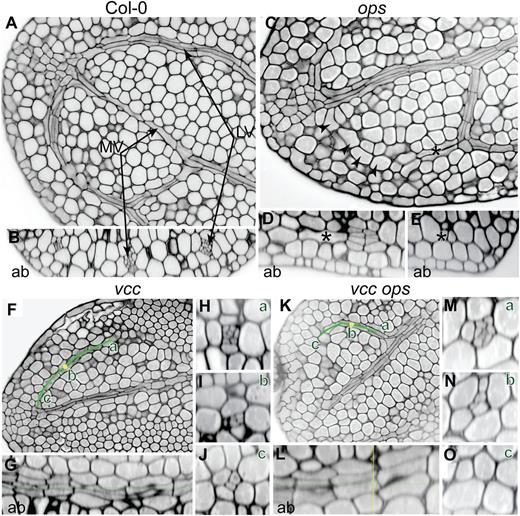 Histological characterization of vasculature in cotyledons. A and B, Median longitudinal optical sectioning of a Col-0 cotyledon (A) and its corresponding transversal sectioning (B) showing complete division of the procambium into phloem and xylem initials. C, Median longitudinal section of an ops-4 cotyledon showing a gap in the vascular networks (arrowheads). D and E, Trans-section (D) and lateral section (E) in the distal loop in the positions indicated by the asterisks showing a progressive loss of procambial divisions. F, Median longitudinal sectioning of a vcc-3 cotyledon. The green line indicates the vascular loop. G, Curved lateral section of the corresponding loop indicated by the green line in G. H to J, Three different trans-sections at different positions of the green line, from proximal (a) to median (b; yellow dot) to distal (c) positions. K, Median longitudinal section of a vcc-3 ops-4 cotyledon. L, Curved lateral section of the corresponding loop through the green line in K. M to O, Three different trans-sections at different positions of the green line, from proximal (a) to median (b; yellow dot) to distal (c) positions. Ab, Abaxial; LV, lateral vein; MV, middle vein. Bars = 10 μm.