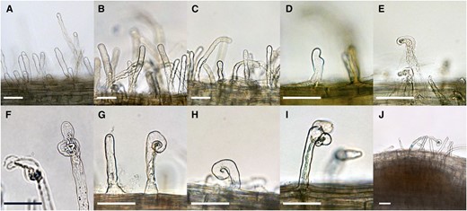 Root responses and infection development during the experimental time course. Roots of 5-d-old M. truncatula seedlings were inoculated with S. medicae ABS7M constitutively expressing the lacZ gene. Morphological features, including root hair deformations and inner cortical cell divisions, were monitored in the susceptible zone proximal to the root tip across time. A, Uninoculated roots. B, Roots at 0.5 hpi. C, Roots at 1 hpi. D, Roots at 3 hpi. E, Roots at 6 hpi. F, Roots at 12 hpi, G, Roots at 24 hpi. H, Roots at 36 hpi. I, Roots at 48 hpi. J, Roots at 72 hpi. Scale bars = 50 μm.