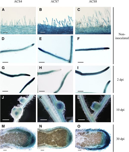 Histochemical localization of the expression of the three symbiosis-responsive ACS genes in M. truncatula roots at different stages after inoculation. The promoter of three ACS genes was cloned in fusion with the GUS reporter gene in the pLP100 binary vector. M. truncatula roots were transformed by hairy root transformation. The expression of gene ACS4 is represented in A to M, ACS7 in B to N, and ACS8 in C to O. A to F, Bright-field images of 5-bromo-4-chloro-3-indolyl-β-glucuronic acid (X-Gluc)-stained roots before inoculation. G to I, Roots at 24 hpi. J to L, Roots at 10 dpi. M to O, Roots at 30 dpi. Bars = 25 µm (A–C), 500 µm (D–L), and 100 µm (M–O).