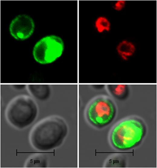 Subcellular localization of OSPSX-MFS3 proteins in yeast cells. Localization of N-terminal GFP of OsSPX-MFS proteins in yeast by confocal laser scanning microscopy. The green signals indicate GFP, and the red signals indicate vacuolar membranes that were specifically stained with the dye FM4-64. Bars = 5 µm.