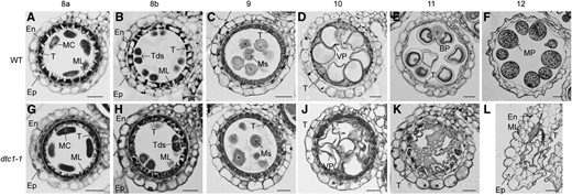 Transverse-sectional comparisons between wild-type and dtc1-1 anthers. Cross sections of wild type (A–F) and dtc1-1(G–L) anthers at ST8a (A and G), ST8b (B and H), ST9 (C and I), ST10 (D and J), ST11 (E and K), and ST12 (F and L). BP, Binuclear pollen; En, endothecial cell; Ep, epidermal cell; MC, meiocyte; ML, middle layer; MP, mature pollen; Ms, microspore; T, tapetal cell; Tds, tetrads; VP, vacuolated pollen. Bars = 20 μm.