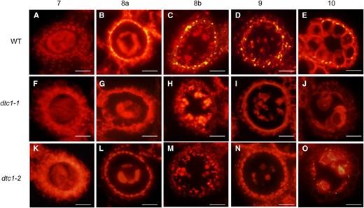 Detection of DNA fragmentation by TUNEL assays. Signals from anthers of WT (A- E), dtc1-1 (F- J), and dtc1-2 (K- O) at ST7 and ST10. Nuclei were stained with propidium iodide (PI) indicated by red fluorescence. Yellow fluorescence shows TUNEL-positive regions. Bars = 20 μm.