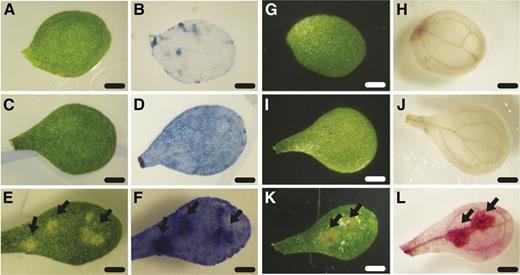 Vital staining of unaffected and affected tissue from wild-type and ago1-27 cotyledons. A and G, Unaffected wild-type cotyledons prior to staining. B, Unaffected wild-type cotyledon after Trypan Blue staining showed little dye accumulation. H, Unaffected wild-type cotyledon after DAB staining showed little dye polymerization. C and I, Unaffected ago1-27 cotyledons prior to staining. D, Unaffected ago1-27 cotyledon after Trypan Blue staining showed some dye accumulation. J, Unaffected ago1-27 cotyledon after DAB staining showed no dye polymerization. E and K, Affected ago1-27 cotyledons prior to staining. F, Affected ago1-27 cotyledon after Trypan Blue staining showed strong accumulation of dye in lesions (arrows). L, Affected ago1-27 cotyledon after DAB staining showed strong dye polymerization in lesions (arrows). Bars = 1 mm.