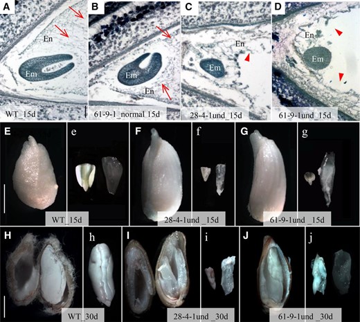 Underdeveloped GhVIN-RNAi seeds exhibited impaired filial tissue growth. A to D, Toluidine Blue staining of longitudinal sections of 15-d fully developed seed from wild-type (WT) cotton (A) and GhVIN-RNAi 61-9-1 (B) and underdeveloped seed from RNAi 28-4-1 (C) and RNAi 61-9-1 (D). Note that the fully developed seeds had progressed to torpedo embryo stage with cellularized endosperms (arrows in A and B), whereas the underdeveloped seeds remained in the globular embryo stage with disrupted or limited endosperm cellularization (arrowheads in C and D). E to g, Compared with the 15-d wild-type seed (E and e), line 28-4-1 (F and f) and 61-9-1 (G and g) underdeveloped seeds showed slightly bigger seed size but retarded filial tissue growth. H to j, Compared with the fully developed cotyledon embryo in the wild-type seed at 30 d, where endosperm was fully absorbed (H and h), line 28-4-1 (I and i) and 61-9-1 (J and j) underdeveloped seeds exhibited stunted embryo growth with endosperm remaining. Images labeled by lowercase letters show embryo (left) and endosperm (right) tissues isolated from the seeds presented in the images labeled with the same uppercase letters. Bars = 100 μm in A and 5 mm in E and H. The scales in B to D are the same as that in A, and the scales in e to g and h to j are same as those in E and H, respectively.