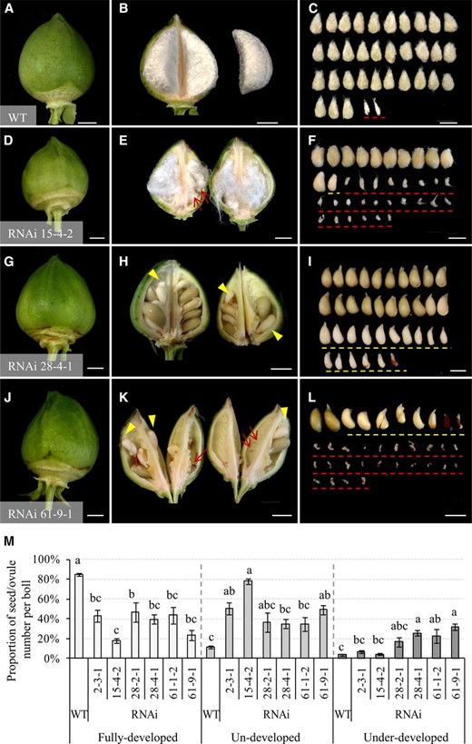 Unviable cotton seeds comprised undeveloped and underdeveloped seeds from the GhVIN1-RNAi lines. A to L, Representative images of 30-d cotton bolls and seeds from the wild type (WT; A–C) and lines 15-4-2 (D–F), 28-4-1 (G–I), and 61-9-1 (J–L). The undeveloped seeds are indicated by red arrows and dashed lines (E, F, K, and L), whereas the underdeveloped seeds are shown by yellow arrowheads and dashed lines (F, H, I, K, and L). Bars = 1 cm. M, Proportions of the fully developed, undeveloped, and underdeveloped seeds per boll in wild-type and T3 GhVIN1-RNAi plants. Each value is the mean ± se of at least 30 cotton bolls from eight individuals of each line in two independent trials. Different letters indicate significant differences at P < 0.05 according to one-way ANOVA.