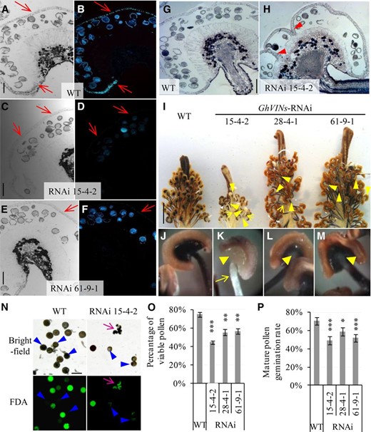 GhVIN1-RNAi lines displayed unthickened endothecium walls, incomplete septum degradation in a certain number of −1-d anthers, reduced starch accumulation in −1-d stamens, and lowered pollen viability and pollen tube germination rates. A to F, Representative images of −1-d wild-type (WT; A and B), RNAi 15-4-2 (C and D), and RNAi 61-9-1 (E and F) anther sections stained with Aniline Blue, observed under bright field (A, C, and E) and UV light (B, D, and F). Red arrows indicate the position of the anther wall. G and H, Representative images of −1-d wild-type (G) and RNAi 15-4-2 (H) anther sections stained with Toluidine Blue. Note the remaining septum (arrowheads in H) but its absence in G. I, Representative image of wild-type and transgenic −1-d stamens and styles stained with KI-I2. J to M, Magnified views of stamen from the wild type (J), RNAi 15-4-2 (K), RNAi 28-4-1 (L), and RNAi 61-9-1 (M), respectively. Compared with the strong staining of starch in the wild-type stamen by KI-I2, indicated by the dark color, the transgenic stamen exhibited much weaker staining in filaments and especially at the anther-filament joint regions (yellow arrow and arrowheads, respectively). N, Bright-field and green fluorescence images of the same set of mature pollen grains stained with FDA from the wild type and RNAi line 15-4-2. Pink arrows indicate malformed pollen grains. Blue arrowheads point to pollen grains with lost viability. O, The proportions of viable pollen grains determined by FDA staining were reduced significantly in the transgenic lines compared with the wild type. Each value is the mean ± se from four biological replicates. P, Pollen germination rates were reduced significantly in the GhVIN1-RNAi lines compared with the wild type. Each value is the mean ± se of eight flowers from four plants for each line. Asterisks indicate significant difference between RNAi and wild-type plants based on one-way ANOVA after arcsine transformation (*, P < 0.05; **, P < 0.01; and ***, P < 0.001). Bars = 100 μm in A, C, E, G, and N and 1 cm in I. The scales in B, D, F, and H are the same as those in A, C, E, and G, respectively.