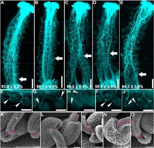 Functional loss of AP‐3 affects the growth but not the guidance of pollen tubes in vivo. A to J, Representative Aniline Blue staining of wild-type pistils emasculated and hand pollinated with pollen from the wild type (A and F), ap-3δ (B and G), ap-3β (C and H), ap-3µ (D and I), and ap-3σ (E and J) at 9 HAP. Arrows point at the front of in vivo growing pollen tubes; arrowheads point at the micropyle where pollen tubes arrive. The relative distance that pollen tubes travel within the transmitting tract is quantified with 15 pistils, and the results are shown at the bottom of A to E (means ± sd). Each mutant is significantly different from the wild type in the length of in vivo growing pollen tubes (one-way ANOVA, Dunnett’s multiple comparison test, P < 0.05). K to O, SEM images of wild-type ovules hand pollinated with pollen from the wild type (K), ap-3δ (L), ap-3β (M), ap-3µ (N), and ap-3σ (O) at 9 HAP. Pollen tubes growing toward the micropyle are false-colored pink. Bars = 200 μm for A to E, 100 μm for F to J, and 20 μm for K to O.