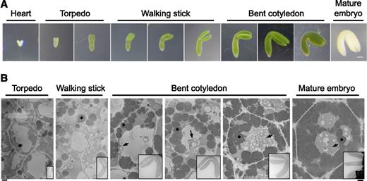 Stages assigned to Arabidopsis embryo development and an overview of PSV formation in a representative cell from selected stages. A, Images of heart, torpedo, walking stick, and bent cotyledon embryos dissected from Arabidopsis ovules. The mature embryo was dissected from a dry seed. Bar = 100 µm. B, PSV arise during the maturation phase of embryonic development. Images shows single micrographs from SBF-SEM stacks of embryos at different developmental stages. Deposits of electron-opaque material (arrows) are first observed in the vacuole lumen and along the tonoplast of the EV in early-bent cotyledon embryos. The deposits accumulate and eventually fill the vacuolar lumen in mature seed. Asterisks indicate oil bodies. Bar at left for high-magnification images = 1 µm; bar at right for inset overview images = 100 µm.