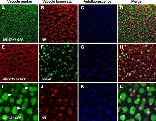 Forming PSV are identified by the acidotropic stains NR and BCECF-AM and PSV luminal autofluorescence in bent cotyledon embryos. A to H, NR and BCECF-AM stain vacuoles labeled with the tonoplast markers TPK1-GFP (A) and VHA-a3-RFP (E), respectively. Vacuole lumen autofluorescence (blue) colocalizes with the stains (D and H). I to L, Embryos accumulating 2S1 albumin-GFP were stained with NR. The 2S1-GFP signal fills vacuole lumina, and areas of more intense GFP fluorescence are observed (arrowheads in I). NR stains distinct subregions of the vacuole lumina (J). These NR-stained subregions colocalize with PSV lumen autofluorescence (K) and with areas of intense 2S1-GFP fluorescence (L). Bars = 10 μm (A–H) and 5 μm (I–l).