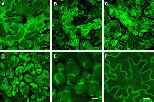 The tonoplast undergoes extensive remodeling during the LV-to-PSV transition in LEC2-induced leaf cells. Representative images show the progression of tonoplast remodeling during the LV-to-PSV transition at 14 d (A), 17 d (B and C), and 20 d (D and E) with DEX or at 14 d without DEX (F). Arabidopsis 35S:LEC2-GR lines harboring 35S:TPK1-GFP (green) were imaged. Images are maximum intensity projections of Z-stacks taken through leaf epidermal cells. Bars = 10 µm.