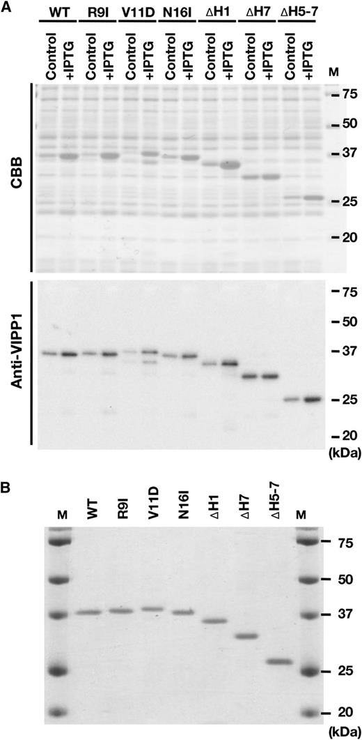 Preparation of recombinant VIPP1-His proteins. A, Expression of recombinant VIPP1-His proteins in E. coli cells, which was confirmed by SDS-PAGE and either Coomassie Brilliant Blue (CBB) staining or immunoblot analyses. B, Composition of protein solutions used for this study. The final protein preparation (0.2 µg protein lane−1) was subjected to SDS-PAGE and Coomassie Brilliant Blue staining to confirm most VIPP1-His proteins.