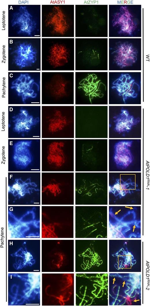 Immunolocalization of AtASY1 and AtZYP1 in the wild type and AtPOLD1RNAi. The distribution of AtASY1 and AtZYP1 in the wild type and AtPOLD1RNAi is shown at leptotene (A and D), zygotene (B and E), and pachytene (C and F–I). G and I show enlarged regions from F and H, respectively. DAPI staining is shown in blue, AtASY1 in red, and AtZYP1 in green. Yellow arrows indicate bubbles and bifurcations with aberrant AtZYP1. Bars = 5 μm. WT, wild type.
