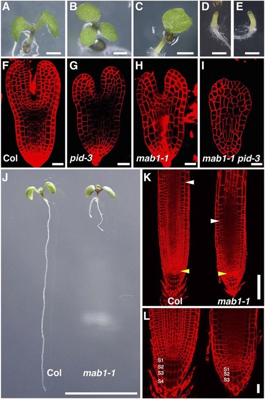 Defective organ development in mab1 mutants. A to E, Five-day-old seedlings: Wild type (Col; A), pid-3 (B), mab1-1 (C), mab1-1 pid-3 (D), and mab1-2 pid-3 (E). F to I, Comparison of wild-type (Col; F), pid-3 (G), mab1-1 (H), and mab1-1 pid-3 (I) embryos at the late heart stage. J, Root development in 5-d-old wild-type (Col; left) and mab1-1 (right) seedlings. mab1-1 mutants show a short root phenotype. K and L, Comparison of wild-type (Col; left) and mab1-1 (right) root meristems. S1 to S4 indicate columella cell tiers. Yellow arrowheads indicate quiescent center cells, whereas white arrowheads represent the cortex transition zones (K). Scale bars = 1 mm (A to E), 20 µm (F to I, L), 1 cm (J), and 100 µm (K).