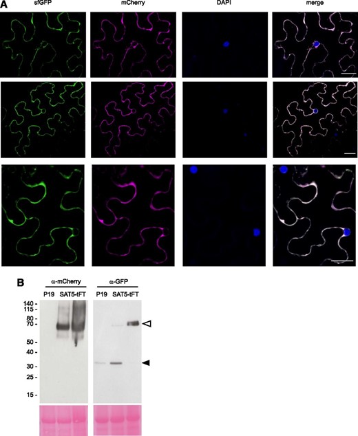 C-terminal mCherry-sfGFP demonstrates cytosolic localization of SAT5. A, N. benthamiana leaves were transiently transformed with a construct expressing SAT5-tFT under the control of the CaMV35S promoter. The images show false-colored confocal micrographs of three different cells, counterstained with 4′,6-diamidino-2-phenylindole (DAPI) to mark nuclei. Bars = 30 µm. B, Immunoblots of different leaves infiltrated with the P19 suppressor of gene silencing (left lanes) or SAT5-tFT plus P19 (middle and right lanes). Blots (50 mg of protein per lane) were probed with antisera toward GFP or mCherry, as indicated. The gels at bottom show Ponceau S staining following transfer, and the positions of molecular mass markers (kD) are indicated to the left. The white arrowhead indicates the position of SAT5-tFT, and the black arrowhead indicates a P19-specific band.