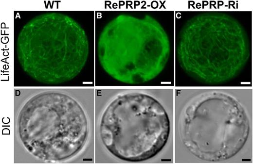 OsRePRP affects F-actin organization in root protoplasts. Transient expression of LifeAct-GFP in 5-d-old rice root protoplasts from the wild type (A and D), OsRePRP2-OX (B and E), and OsRePRP-Ri (C and F). GFP signals are shown in green (A–C) and the DIC channel indicates bright-field images (D–F). Images in A to C represent the maximum intensity projection of 20 optical confocal images with identical settings. Three independent transgenic lines for each genotype were observed (OsRePRP2-OX lines 2, 10, and 24 and OsRePRP-Ri lines 5–7). Scale bars = 2 μm.