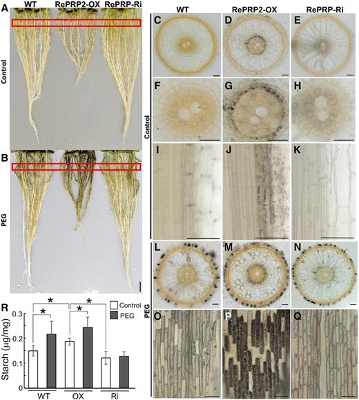 Starch accumulation in rice roots after PEG treatment. A and B, Iodine-stained rice roots from 14-d-old seedlings of the wild type (WT), OsRePRP2-OX, and OsRePRP-Ri under control (A) or PEG (B) treatments. Red rectangles indicate root areas that were sectioned for observation in C to. Four biological replicates were performed and at least two independent transgenic plants for each genotype were observed (OsRePRP2-OX lines 2 and 24 and OsRePRP-Ri lines 5–7). C to Q, Cross and longitudinal iodine-stained root sections of the wild type (C, F, I, L, and O), OsRePRP2-OX (D, G, J, M, and P), and OsRePRP-Ri (E, H, K, N, and Q) under control (C–K) or PEG (L–Q) treatments. Three biological replicates were performed, and at least two independent transgenic lines for each genotype were observed (OsRePRP2-OX lines 10, 19, and 24 and OsRePRP-Ri lines 5 and 7). R, Starch content measurements in whole roots of the wild type, OsRePRP2-OX (OX), and OsRePRP-Ri (Ri) under control or PEG treatments. Significant differences are indicated with asterisks (P < 0.05, two-tailed Mann-Whitney U test). Data are means ± sd of six technical repeats. Three biological replicates were performed and two independent transgenic lines for each genotype were measured (OsRePRP2-OX lines 10 and 24 and OsRePRP-Ri lines 5 and 6). Scale bars = 1 cm (A and B) and 50 μm (C–Q).