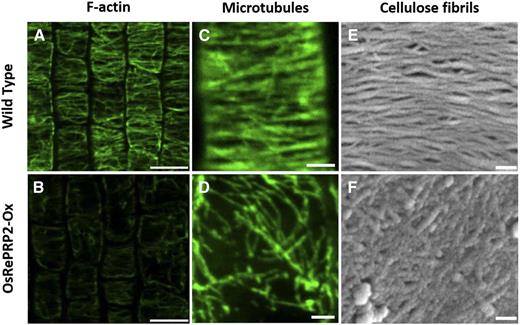 OsRePRPs affect plant cytoskeleton organization. Micrographs show actin filaments (A and B) and microtubules (C and D) detected with fluorescent markers and cellulose fibrils (E and F) observed by scanning electron microscopy. Phenotypes were analyzed in roots of wild-type and OsRePRP2 overexpressor (OsRePRP2-Ox) plants. Bars = 10 μm (A and B), 2 μm (C and D), and 100 nm (E and F). Reproduced from Hsiao et al. (2020), figures 4, 5, and 6.