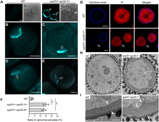 Cell plate and intine defects in syp31 syp32 BCP. A, Ectopic callose deposition in syp31 syp32-1 late BCP. n = 317, n = 265, and n = 204 pollen for WT, syp31/+ syp32-1/+, and syp31/+ syp32-2/+ plants, respectively. Arrows in (A) indicate abnormal pollen. B–E, Aniline blue staining of PMI pollen of WT (B) and syp31 syp32-1 (C–E). Arrows in (C)–(E) indicate abnormal cell plates. F, The statistical analysis of PMI pollen positive for aniline blue staining. n = 202, n = 167, and n = 183 pollen for WT, syp31/+ syp32-1/+ and syp31/+ syp32-2/+ plants, respectively. Pollen from three plants was counted for each genotype. Values represent the means SD, **P < 0.01 by two-tailed Student’s t test. G, Cellulose deposition is defective in syp31 syp32-1 pollen. Cellulose and cytoplasm are labeled with calcofluor white (blue) and PI (red), respectively. Arrows indicate pollen with no Calcofluor white staining. H, TEM analysis revealed abnormal intine deposition in syp31 syp32-1 pollen. GC, generative cell; VN, vegetative nucleus; I, Magnified images of the boxed areas in (H). Intine thickness is indicated by pairs of white arrowheads. Bars = 5 μm (A–E and G) and 500 nm (H and I).