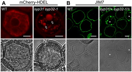 Membrane trafficking is defective in syp31 syp32-1 pollen. A, Confocal images of WT and syp31 syp32-1 unicellular pollen expressing pUbiquitin10: mCherry-HDEL. Vacuole signals (arrows) were detected in ∼19% of pollen of syp31/+ syp32-1/+ plants (n = 79). B, JIM7-labeling of pectins was blocked inside BCP (8/38) of mutants as punctuate structures. Semi-thin anther sections were used for labeling. Asterisks indicate JIM7 positive signals. Bars = 5 μm.