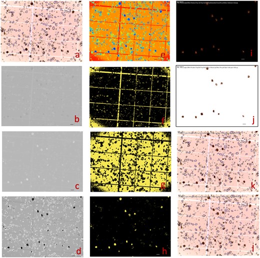 Counting and measuring spore balls from potato using GridFree. The picture was provided by Tanaka Lab at Washington State University (https://labs.wsu.edu/tanaka-lab). The objective was to count and measure the brown spore balls (A). Among the 10 PCs from the RGB channels and the derived 7 indices, 3 are displayed for PC1 (B), PC7 (C), and a combination of PC7 with RGB PC1 with weight of 0.312 (D). PC3 was the best at differentiating the spore balls from the background and was used for cluster analysis with five clusters (E). Among the five clusters, Clusters 4 (F), 3 (G), and 1 (H) are displayed. Cluster 1 uniquely captured the spore balls and was used for segmentation. The segments were filtered to match the maximum and minimum spore ball sizes. The final segmentation results are displayed for extracted POI on a black background (I), on a white background (J), and on the raw image with segments represented as red-outlined boxes (L) and with measurements on length, width, and counting numbers (K). Scale bars in figure (A) through (L) is 100 μm