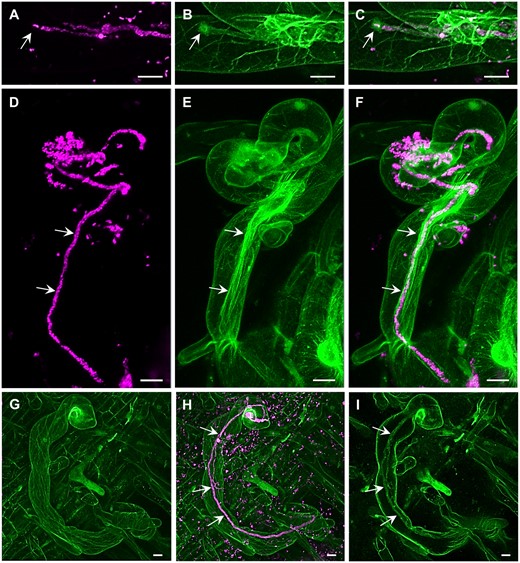 Super-resolution mode of the Airycsan confocal laser scanning microscope used for the simultaneous imaging of S. meliloti (magenta) and the host cytoskeleton (green) in transgenic alfalfa plants carrying genetically encoded cytoskeletal markers (GFP-FABD2 for actin and GFP-MBD for MTs). Actin filaments and bundles (A–F, Supplemental Video S12) and MTs (G–I, Supplemental Video S13) in root hairs infected by S. meliloti labeled by mRFP within ITs. Actin accumulated around the apex of growing IT (arrows in A–C), and decorated fully grown IT in the form of longitudinal bundled filaments (arrows in D–F, Supplemental Video S12). MTs were longitudinally arranged in the extensive cortical network (G and H, Supplemental Video S13) and only occasionally were associated with fully grown IT (arrows in H and I) in root hairs (I). Bar = 10 µm (A–I). Imaging: Dry Plan-Apochromat 20×/0.8 NA, 488 nm (for GFP excitation) and 561 nm (for mRFP excitation) at 2% and 0.6% of relative laser power level, respectively, BP 420–480 + BP 495–550 for GFP signal detection and BP 420–480 + LP 605 for RFP signal detection, image scaling 0.074 × 0.074 × 0.397 µm (x × y × z), pixel dwell time 1.98 µs.