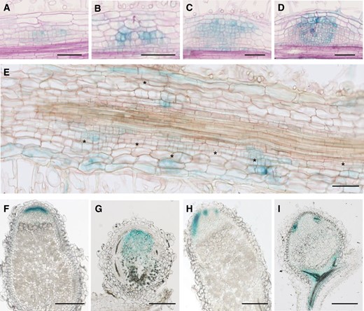 Cortical cell divisions and CK signaling are modified in Mtefd-1 S. meliloti-inoculated roots and nodules. A–D, Expression pattern of the CK signaling reporter TCSn:GUS in young (stage III: A and B) and older (stages IV and V: C and D) nodule primordia, in wt (A and C) and Mtefd-1 (B and D) backgrounds, at 4 dpi with S. meliloti phemA:lacZ, using A. rhizogenes-transformed plants (10 µm sections), following revelation of GUS and LacZ activity (blue and violet signal, respectively). Note the stronger GUS signal in Mtefd-1. E, Section (10 µm) of TCSn:GUS Mtefd-1 roots at 4 dpi following GUS staining. Note the presence of numerous cortical cell divisions (asterisks) within and between nodule primordia. F–G, Expression of TCSn:GUS in mature wt (F) and Mtefd-1 (G) nodules (50 µm sections). H–I, Expression of pWOX5:GUS in mature wt (H) and Mtefd-1 (I) nodules (50 µm sections). F–I, Nodules were analyzed at 21 dpi. Bars = 100 µm (A–E) or 250 µm (F–I).