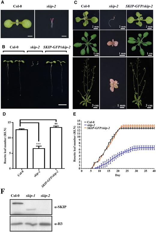 SKIP is an essential part of the Arabidopsis life cycle. A, Seven-day-old wild-type and skip-2 plants. Scale bar = 1 mm. B, Seven-day-old wild-type, skip-2, and skip-2 complemented (pSKIP::SKIP-GFP/skip-2) plants. At least 10 independent transgenic lines with similar phenotypes were observed; one representative line is shown. Scale bar: 1 cm. C, Wild-type, skip-2, and skip-2 complemented (pSKIP::SKIP-GFP/skip-2) plants at 14 days old (top), 21 days old (middle), and 35 days old (bottom). D, The rosette leaf number in wild-type, skip-2, and skip-2 complemented (pSKIP::SKIP-GFP/skip-2) plants. The data represent the mean ± sd from three biological replicates. ***P < 0.001 (Student’s t test). ns: no significant difference. E, Leaf emergence in wild-type, skip-2, and skip-2 complemented (pSKIP::SKIP-GFP/skip-2) plants. The data represent the mean ± sd from three biological replicates. F, Western blot analysis of SKIP protein expression from wild-type and skip alleles using anti-SKIP antibodies.