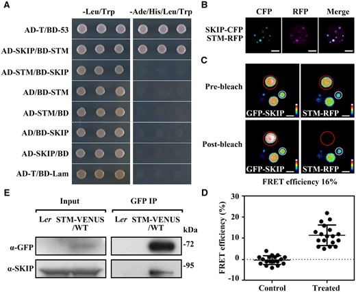 SKIP interacts physically with STM in planta. A, Yeast two-hybrid assay. AD-T/BD-53 is the positive control; AD-T/BD-Lam is the negative control. The interaction between SKIP and STM was assessed by growth on medium lacking leucine and tryptophan (–Leu/Trp, as a growth control) or lacking adenine, histidine, leucine, and tryptophan (–Ade/His/Leu/Trp, as a growth test). B, Colocalization assay in N. benthamiana cells. Laser scanning confocal microscope images from the CFP, RFP, and both (Merge) channels are shown. Scale bar: 5 μm. C, FRET assay in N. benthamiana cells. Laser scanning confocal microscope images from the GFP and RFP channels before and after SKIP-RFP photobleaching are shown. Different colors indicate the difference in fluorescence intensity in the barcode. Efficiency of FRET = (post ID-pre ID)/post ID, where ID is the intensity of the donor (GFP). Scale bar: 2 μm. D, The FRET efficiency from individual cells of three independent biological replicates. The control data were calculated from the nuclear speckle marked with a white circle in (C). The treated data were calculated from the nuclear speckle marked with a red circle in (C). The data represent the mean ± sd from 18 cells. E, Co-IP assay of the interaction between SKIP and STM in Arabidopsis. Total protein from inflorescences containing only unopened flowers in a wild-type (Ler) or pSTM::STM-VENUS (Ler background) background was immunoprecipitated with GFP-trap magnetic beads. The immunoprecipitate was analyzed by Western blotting using anti-GFP or anti-SKIP antibodies as indicated on the left.