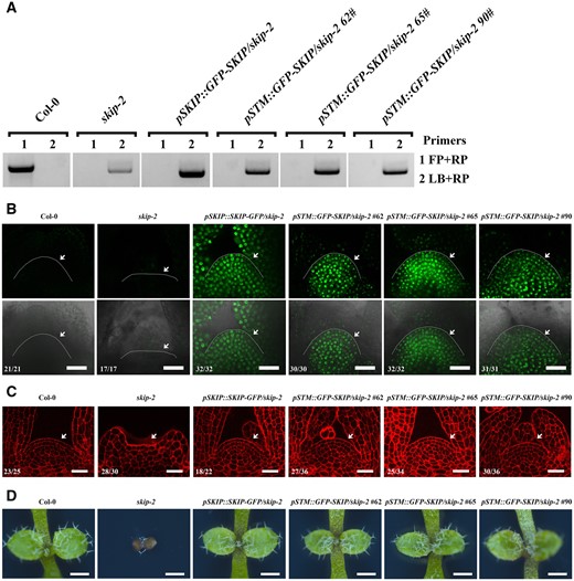 SKIP expression in the SAM region complemented the defect in SAM formation in skip-2. A, Genotyping of complemented skip-2 transgenic plants by the transformation of pSTM::GFP-SKIP into skip-2. FP is forward primer; RP is reverse primer; LB is primer in T-DNA. B, Laser scanning confocal microscope images of the SAM in 9-day-old plants using the GFP channel (top) and “Merge” (bright-field + GFP) channel (bottom). Scale bar: 30 μm. Arrowheads indicate the SAM. C, Laser scanning confocal microscope observations of the SAM in 7-day-old plants following mPS-PI staining. Scale bar: 30 μm. Arrowheads indicate the SAM. The numbers in (B) and (C) indicate the number of plants that exhibited a similar pattern out of the total number of plants observed. D, Dissecting microscope images of the shoot apices of 7-day-old plants. Scale bar: 500 μm.