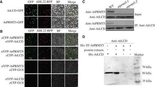 AtPRMT5 interacts with AtLCD. A, Subcellular localizations of the AtLCD and AtPRMT5 proteins. Confocal images of N. benthamiana leaf cells harboring the pMDC43-AtLCD or pMDC43-AtPRMT5 constructs. AHL22 was used as an indicator of nuclei; BF, bright field. Scale bar, 10 μm. B, The interaction between AtLCD and AtPRMT5 in N. benthamiana leaves. Pairwise expression of nYFP-AtPRMT5, cCFP-AtPRMT5, nYFP-AtLCD, cCFP-AtLCD, and cCFP-GUS constructs in N. benthamiana. AHL22 was used as an indicator of nuclei. BF, bright field. cCFP-GUS was used as a negative control. Scale bar, 10 μm. C, The combination of AtLCD and AtPRMT5 in 14-day-old Arabidopsis. Protein extracts of WT were immunoprecipitated by anti-AtLCD antibody, and then, the precipitates were exposed to anti-AtPRMT5 or anti-AtLCD antibodies. D, Pull-down assays of AtLCD and AtPRMT5. Recombinant protein His-TF-AtPRMT5 binds to Ni-NTA agarose matrix, then incubated with protein extracts from WT plants, the precipitates were immunoblotted with anti-AtLCD antibody.