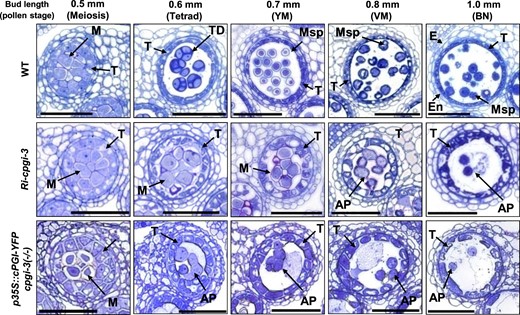 Anther defects in Ri-cpgi-3 and p35S::cPGI-YFP cpgi-3(−/−) plants. Representative micrographs show one of the four locules in semi-thin cross-sections of anthers from the indicated length of developing floral buds in the WT (top), Ri-cpgi-3 (middle), and p35S::cPGI-YFP cpgi-3(−/−) (bottom) plants. The pollen stages corresponding to the bud sizes in WT plants are indicated in parentheses. AP, abnormal pollen; E, epidermis; En, endothecium; M, meiocyte; Msp, microspore; T, tapetum; TD, tetrad; YM, young microspore stage; VM, vacuolated microspore stage; BN, binucleate pollen stage. Bars = 50 µm.