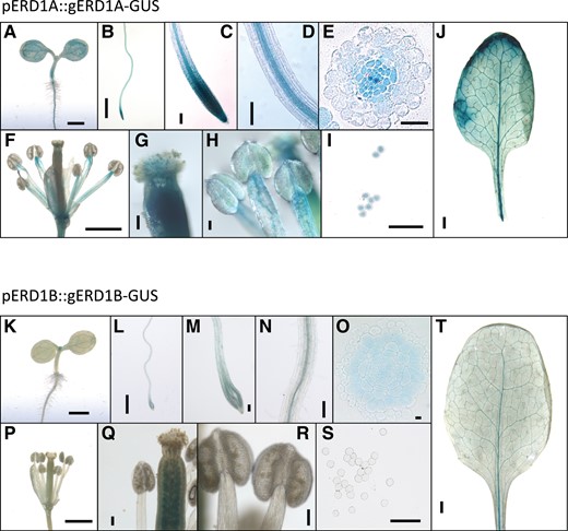 ERD1A and ERD1B are widely expressed in various tissues. The β-glucuronidase (GUS) staining profile for the erd1a mutant complemented by the pERD1A::ERD1A-GUS construct and incubated for 6 h in X-GlcA A)–J) and for WT plants transformed with the pERD1B::ERD1B-GUS construct and incubated for 16 h in X-GlcA K)–T). The GUS profile is shown for 3-d-old seedlings A), K) and 7-d-old roots B)–E), L)-O); flowers F), P); pistils G), Q); stamens H), R); pollen grains I), S); and mature leaves J), T). Scale bars, 1 mm A), B), F), J), K), L), P), and T); 100 µm C), D), G), H), I), M), N), Q), R) and S); and 10 µm E) and O).