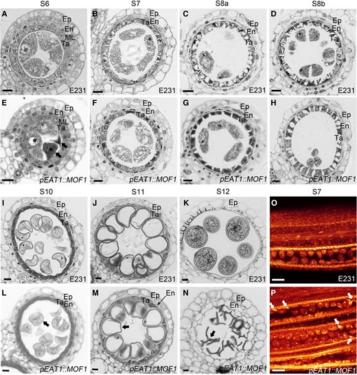 Anther development in pEAT1::MOF1.(A to D, I to K) Anther sectioning of E231 plants (the wild-type control). (E to H, L to N) Anther sectioning of pEAT1::MOF1 plants. Black arrows indicate abnormal male sex cells at the indicated anther stages. Black bars = 10 μm. (O, P) WE-CLSM observation of E231 O) and pEAT1::MOF1P) meiotic anthers. White arrows indicate degenerated male sex cells at the S7 anther. White bars = 40 μm.