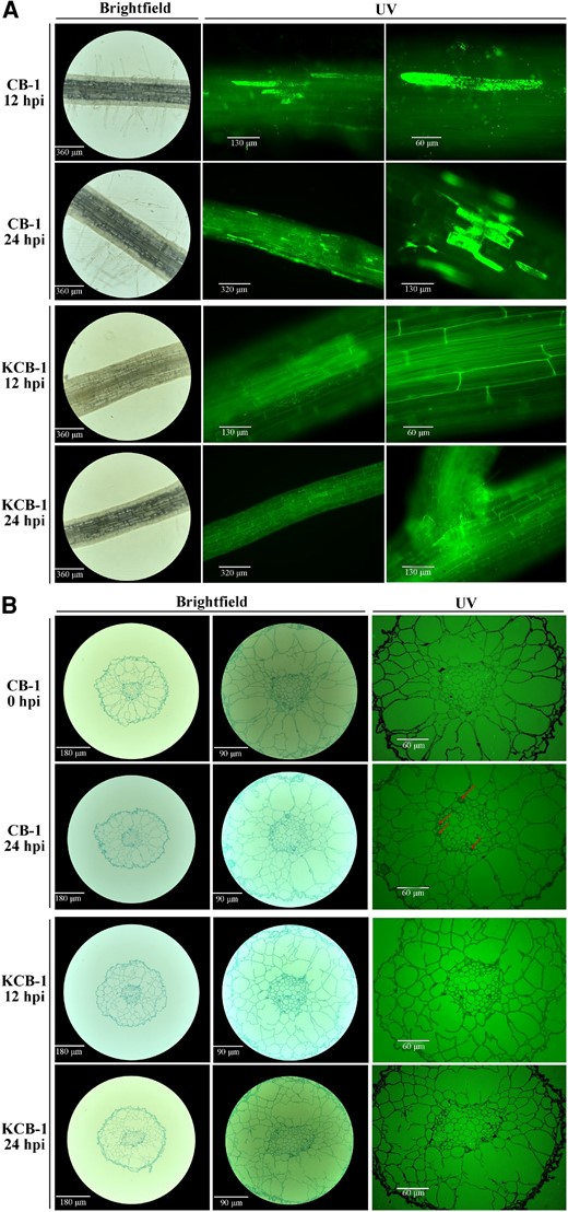 Colonization of roots of CB-1 and KCB-1 by R. solanacearum. A) Longitudinal colonization of roots of CB-1 and KCB-1 by R. solanacearum at 12 and 24 hpi. B) Cross-section of roots of CB-1 and KCB-1 at 0 and 24 hpi. hpi, hours post-infection.