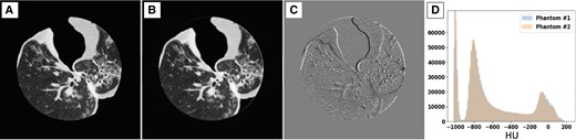 Comparison between two 3D-printed phantoms (A, B), both based on the moderate COVID-19 patient, scanned separately at a high (non-clinical) dose level show high structural similarities and imaging features, implying high reproducibility of the PixelPrint phantom production process. Window level/width is −400/1,000 HU. C) Difference image between the two sets of images reveals that most of the differences between the images are mainly due to slight misalignments between the two phantoms. Window level/width is 0/200 HU. D) Histograms of CT numbers within the entire phantom volume demonstrate excellent reproducibility.