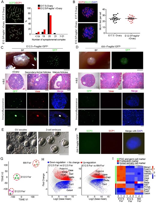 Neo-meiosis and functional test of oocytes developed from Fragilis+ cells. (A) Immunofluorescence of SCP1 (red) and SCP3 (green, appear as yellowish by merge with SCP1) showing pachytene spread of E12.5 Fragilis+ cells obtained from aggregates with fetal E12.5 somatic cells 6 days following transplantation, compared with those of E17.5 ovaries. Right panel, Percentage of synaptonemal complex elements based on count of spread at pachytene (n = 22). Scale bar = 5 μm. (B) Representative immunofluorescence of MLH1 foci at pachytene stage by co-immunostaining of SCP3 (red) and MLH1 (green). Right panel, Statistics of MLH1 foci represents 20 spread per each group. Scale bar = 5 μm. (C) Morphology of reconstituted ovaries 28 days following transplantation of E12.5 Fragilis+ cells aggregated with E12.5 gonadal somatic cells into kidney capsules of ovariectomized mice (n = 8). Scale bar = 1 mm (upper panel). Middle panel, Follicles are shown in sections by H&E staining. Scale bar = 100 μm. Bottom panel, Co-immunostaining of GFP (green) and Vasa (red) in reconstituted ovaries. BF, bright-field. Nuclei were stained in blue by Hoechst. Scale bar = 100 μm. (D) Morphology of grafts 28 days following kidney capsule transplantation of 6-week Fragilis+ cells aggregated with E12.5 gonadal somatic cells (n = 3). No follicles but GFP+ somatic cells are seen. (E) Morphology of GV oocytes isolated from reconstituted ovaries developed from E12.5 Fragilis+ cells aggregated with E12.5 gonadal somatic cells, and 2-cell embryos following in vitro maturation (IVM) and fertilization (IVF). (F) Immunofluorescence of SCP1 (red) and SCP3 (green) in aggregates obtained from 6-week old Fragilis+ cells with fetal E12.5 gonadal somatic cells 6 days following transplantation. Scale bar = 10 μm. (G–I) Transcriptome of Fragilis+ and Fragilis− cells sorted from E12.5 ovaries and Fragilis+ cells from 6-week old mouse ovaries. (G) TSNE of global gene expression profiles of Fragilis+ cells sorted from fetal ovaries (E12.5 Fra+), Fragilis− cells sorted from fetal ovaries (E12.5 Fra−) and Fragilis+ cells sorted from 6-week ovaries (6W Fra+). (H) Scatter plots comparing transcriptome among these three cell populations. Parallel diagonal lines indicate threshold in expression difference. Red, up-regulated genes in E12.5 Fra+ cells; blue, down-regulated genes in E12.5 Fra− or in 6W Fra+ cells. (I) Heatmap highlighting gene expression profile of germ cells, proliferation and gonad somatic cells