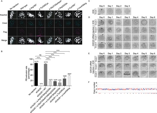 Effects of mutations on CDC20 localization and function in mouse oocytes and phenotypic rescue by CDC20 cRNA injection into oocytes from the proband of family 3 and family 4. (A) Localization of WT and mutant FLAG-tagged CDC20 in mouse oocytes. Hoechst and Crest were used to label the DNA and kinetochores, respectively. (B) The effects of the mutations on the rescue of PB1 extrusion in Cdc20 knockdown mouse oocytes with phenotype of MI arrest. The number of oocytes used are listed on top of the column. Three independent experiments were performed. ****P < 0.0001; ns, not significant. (C) One PB1 oocyte of individual II-1 in family 3 underwent ICSI without CDC20 cRNA injection was used as control. Day 0 indicates the time point at 4 h after ICSI. The black arrowhead indicates the polar body. Scale bar = 40 μm. (D) Four retrieved PB1 oocytes of individual II-1 in family 3 were injected with CDC20 cRNA and cultured for 4 h and then used for ICSI. Oocytes were monitored for 6 days after ICSI. The white arrows indicate the pronuclei. (E)Three retrieved PB1 oocytes of individual II-1 in family 4 were injected with CDC20 cRNA and cultured for 4 h and then used for ICSI. (F) Trophectoderm cells from the blastocyst embryo of individual II-I in family 3 were collected and sequencing for chromosomal copy number variation analysis