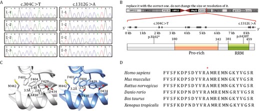 Whole-exome sequencing identified two compound heterozygous variants in the RBM42 gene. (A) Sanger sequencing confirmed that the proband (II-2) inherited the RBM42: c.304C>T variant from her mother (I-2), and the c.1312G>A variant from the father (I-1). Her younger brother (II-3) is not affected. (B) The genomic location and the amino acid changes of the two RBM42 variants. The 438 residue resides in the RRM domain. (C) 3D structural model of wild-type (WT) and mutated RBM42 proteins were constructed by AlphaFold (Jumper et al., 2021). The WT hydrophobic Alanine sits in a hydrophobic pocket which consists of F401, F404, and F429, meanwhile the mutated hydrophilic Threonine may destabilize the protein by a bulkier side chain. (D) Multi-species alignment for RBM42 proteins. The A438 amino acid is conserved across species from xenopus to human.