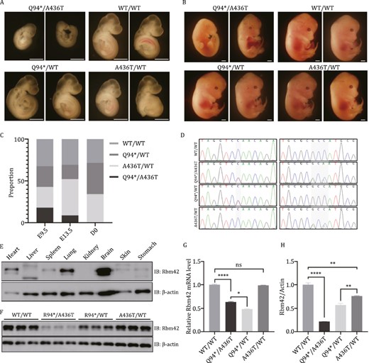 Mouse model harboring Rbm42 variants. (A) Embryo morphology at E9.5. (B) Embryo morphology at E13.5. (C) The ratio of animals with different genotypes during development. (D) Genotyping of different mice by Sanger sequencing. (E) The expression of Rbm42 protein in different organs of newborn WT/WT mice. (F) At E9.5, the expression of Rbm42 protein was measured by Western blot in different genotype mice. (G) At E9.5, the mRNA expression of Rbm42 was measured by qRT-PCR. Results are the mean ± SEM of three independent experiments. (H) At E9.5, the expression of Rbm42 protein was measured by Western blot. Results are the mean ± SEM of three independent experiments. Scale bars: 1 mm. The statistical significance was determined by an unpaired Student’s t test. Data are considered significant when P values are < 0.05 (*), < 0.01(**), < 0.001 (***), or < 0.0001 (****).