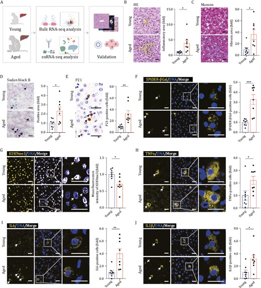 Histological features of liver aging in cynomolgus monkeys. (A) Schematic diagram illustrating sample collection, data analyses and validation. “Young” denotes cynomolgus monkeys 4–6 years old; “Aged” denotes cynomolgus monkeys 18–21 years old. Created with BioRender.com. (B) HE staining in liver tissues from young and aged monkeys. Representative images are shown on the left; quantitative data for the area of inflammatory focus are shown on the right. Scale bars, 25 μm. (C) Masson’s trichrome staining in liver tissues from young and aged monkeys. Representative images are shown on the left; quantitative data for the positive area of fibrosis are shown on the right. Scale bars, 25 μm. (D) Sudan Black B staining in liver tissues from young and aged monkeys. Representative images are shown on the left; quantitative data for the positive area of the Sudan Black B are shown on the right. Scale bars, 25 μm. (E) Immunohistochemistry staining of P21 in liver tissues from young and aged monkeys. Representative images are shown on the left; quantitative data for the percentage of P21-positive cells are shown on the right. Scale bars, 25 μm. (F) Immunofluorescence staining of SPiDER-βGal in liver tissues from young and aged monkeys. Representative images are shown on the left; quantitative data for the percentage of SPiDER-βGal-positive cells are shown on the right. Scale bars, 20 μm. (G) Immunofluorescence staining of H3K9me3 in liver tissues from young and aged monkeys. Representative images are shown on the left; quantitative data for the mean fluorescence intensity of H3K9me3 are shown on the right. Scale bars, 20 μm. (H) Immunofluorescence staining of TNFα in liver tissues from young and aged monkeys. Representative images are shown on the left; quantitative data for the percentage of TNFα-positive cells are shown on the right. Scale bars, 20 μm. (I) Immunofluorescence staining of IL6 in liver tissues from young and aged monkeys. Representative images are shown on the left; quantitative data for the percentage of IL6-positive cells are shown on the right. Scale bars, 20 μm. (I) Immunofluorescence staining of IL1β in liver tissues from young and aged monkeys. Representative images are shown on the left; quantitative data for the percentage of IL1β-positive cells are shown on the right. Scale bars, 20 μm. (B–J) Data are quantified as fold changes and shown as means ± SEM. Young, n = 8 monkeys; aged, n = 8 monkeys. *P < 0.05, **P < 0.01, ***P < 0.001.