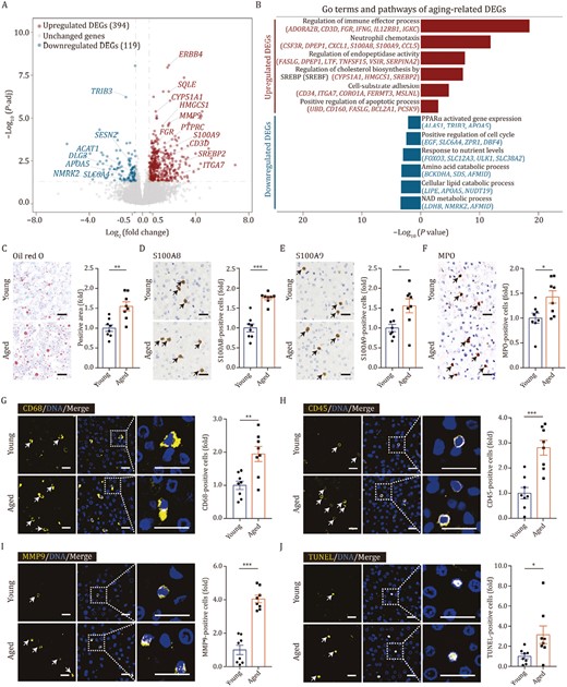 Transcriptomic features of liver aging in cynomolgus monkeys. (A) Volcano plot shows differentially expressed genes (DEGs) of bulk RNA-seq between aged and young livers (aged/young). Red points represent upregulated DEGs; blue points represent downregulated DEGs; gray points represent unchanged genes. (B) Representative GO terms and pathways of upregulated and downregulated DEGs in aged and young monkey livers. (C) Oil red O staining in liver tissues from young and aged monkeys. Representative images are shown on the left; quantitative data for the positive area of the oil red O staining are shown on the right. Scale bars, 25 μm. (D) Immunohistochemistry staining of S100A8 in liver tissues from young and aged monkeys. Representative images are shown on the left; quantitative data for the percentage of S100A8-positive cells are shown on the right. Scale bars, 25 μm. (E) Immunohistochemistry staining of S100A9 in liver tissues from young and aged monkeys. Representative images are shown on the left; quantitative data for the percentage of S100A9-positive cells are shown on the right. Scale bars, 25 μm. (F) Immunohistochemistry staining of MPO in liver tissues from young and aged monkeys. Representative images are shown on the left; quantitative data for the percentage of MPO-positive cells are shown on the right. Scale bars, 25 μm. (G) Immunofluorescence staining of CD68 in liver tissues from young and aged monkeys. Representative images are shown on the left; quantitative data for the percentage of CD68-positive cells are shown on the right. Scale bars, 20 μm. (H) Immunofluorescence staining of CD45 in liver tissues from young and aged monkeys. Representative images are shown on the left; quantitative data for the percentage of CD45-positive cells are shown on the right. Scale bars, 20 μm. (I) Immunofluorescence staining of MMP9 in liver tissues from young and aged monkeys. Representative images are shown on the left; quantitative data for the percentage of MMP9-positive cells are shown on the right. Scale bars, 20 μm. (J) TUNEL staining in liver tissues from young and aged monkeys. Representative images are shown on the left; quantitative data for the percentage of TUNEL-positive cells are shown on the right. Scale bars, 20 μm. (C–J) Data are quantified as fold changes and shown as means ± SEM. Young, n = 8 monkeys; aged, n = 8 monkeys. *P < 0.05, **P < 0.01, ***P < 0.001.