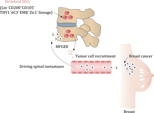 vSSCs driving spinal metastases in breast cancer. The vSSCs, which are characterized by the presence of Zic1, exhibit an immunophenotype of Lin−CD200+CD105−THY1−6C3−EMB−. These vSSCs secrete MFDE8, a molecule that plays a crucial role in attracting breast cancer cells and facilitating their metastasis to the spine.