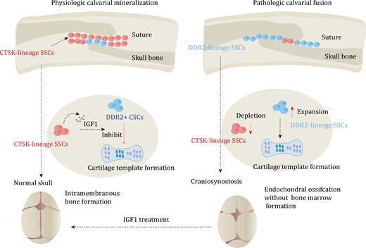 SSCs in calvarial mineralization and craniosynostosis. Calvaria SSCs are labeled by Ctsk. Under normal conditions, Ctsk+ SSCs secrete IGF1 to inhibit endochondral ossification process of DDR2+ SSCs. The process mainly relies on intramembranous ossification, which is dominated by Ctsk+ SSCs. However, in pathologic calvarial fusion, Ctsk+ SSCs become depleted. This depletion leads to the activation of the endochondral ossification process of DDR2+ SSCs, resulting in the occurrence of craniosynostosis. In mice, the administration of IGF1 has been shown to rescue the occurrence of craniosynostosis.