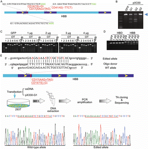 Targeting of theHBBgene in human cells using CRISPR/Cas9. (A) Three gRNA targeting sites were selected for the HBB locus, and the sequence for each gRNA (G1, G2, and G3) is shown with the PAM sequence in green. The three common HBB mutations found in β-thalassemia are indicated in red. Exons are represented by deep blue boxes with yellow arrows indicating transcriptional direction. (B) 293T cells were individually transfected with the three gRNA-Cas9 expression vectors and harvested for genomic DNA isolation 48 h after transfection. A GFP expression vector was used as transfection control. The regions spanning the gRNA target sites were then PCR amplified for the T7E1 assay. Blue arrowhead indicates the expected size for uncut (no mismatch) PCR products. (C) 293T cells were transfected with increasing concentrations (1 μg, 2 μg, 3 μg, 4 μg) of the G1 gRNA-Cas9 vector. A GFP expression vector was used as transfection control. Regions spanning the top 7 predicted off-target sites for each gRNA were PCR amplified for the T7E1 assay. OT, off-target. HBB, on-target editing in the HBB gene locus. (D) The region within the HBD locus that is highly similar to the G1 gRNA-Cas9 target sequence was analyzed as in (C). (E) A ssDNA oligo (Oligo donor) encoding 6 silent mutations (indicated in red) was synthesized (top), and co-transfected with the G1 gRNA-Cas9 construct (pX330-G1) into 293T cells (middle). At 48 h after transfection, genomic DNA was extracted to PCR amplify the region spanning the G1 target site. The PCR products were then subcloned into TA cloning vectors for sequencing analysis. Representative sequencing chromatographs for wild-type and edited alleles are shown with the mutated target region underlined in red (bottom)