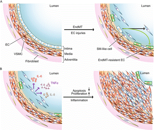 The role of endothelial-to-mesenchymal transition (EndMT) at roughly early (A) and late (B) stages in the pathogenesis of pulmonary hypertension. (A) Genetic and/or microenvironmental insults-induced EC injuries trigger EndMT in pulmonary vasculature. (B) Activated EndMT cells secrete proinflammatory cytokins to potentially stimulate VSMC and/or SM-like cell proliferation and inhibit these cell apoptosis, leading to pulmonary hypertension. Abbreviations: EC, endothelial cell; VSMC, vascular smooth muscle cell; SM-like, smooth muscle-like; IL-6, interleukin-6; IL-8, interleukin-8; TNFα, tumor necrosis factor α