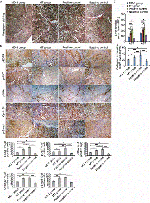 Inhibitory effects of MD-1 on DMN-induced hepatic fibrosis in rats. (A) The sectioned rat liver tissues were stained with Van Gieson staining reagent to show the proliferated collagen fibers (stained with red) segmented and surrounded pseudolobules in the positive control group, and MD-1 treatment significantly reduced the collagen fibers. Original magnification: 200×. (B) Top: Expression of p-EGFR, p-AKT, α-SMA, cyclin D1, and p-Smad in sectioned rat liver was examined by immunohistochemistry. The percentages of positive cells (stained with brown) were counted within five fields of view for each section using a 20× objective lens. Original magnification: 100×. Bottom: Statistics for p-EGFR, p-AKT, α-SMA, cyclin D1, and p-Smad. *P < 0.05; **P < 0.01; ***P < 0.001. (C) Top: Detection of serum ALT and AST levels on fully automated biochemical analyzer. Bottom: Detection of collagen I by ELISA. *P < 0.05; **P < 0.01; *** P < 0.001