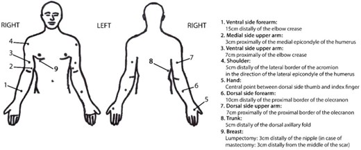 Reference points. Those included in the arm scores were 1, 2, 3, 5, 6, and 7; those included in the trunk scores were 4, 8, and 9. For reference points 1 to 3, the 2 measurement positions were as follows: first, the sitting position with the forearm partly supported on the table; and second, the elbow slightly flexed, supination of the forearm, and the arm slightly abducted. For reference points 4 to 7, the 3 measurement positions were as follows: first, the sitting position with the forearm partly supported on the table; second, pronation of the forearm; and third, the fingers slightly abducted. For reference point 8, the measurement position was the standing position, with the arms relaxed beside the body. For reference point 9, the measurement position was the supine position.